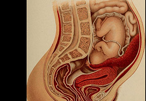 Anterior placenta