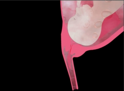 गर्भावस्था के दूसरे और तीसरे तिमाही में योनि खून बहना